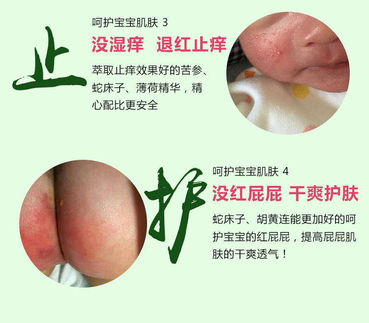 京都藥業(yè)思童百草露祛痱子祛濕疹