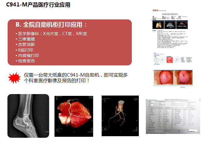 供應放射科膠片打印機OKIC941-M CT CR MR 三維重建科室*