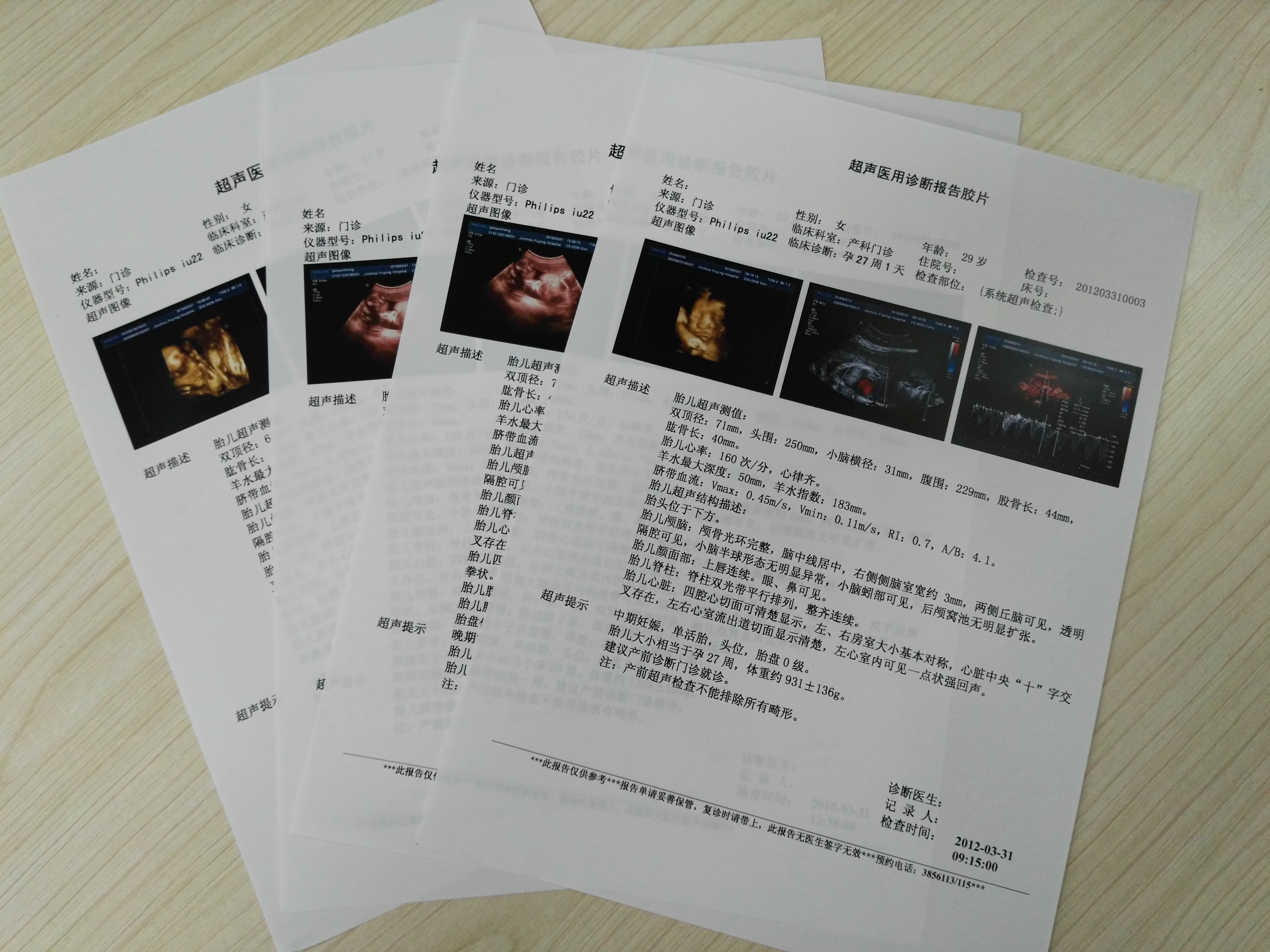 供應(yīng)OKIC711n醫(yī)用膠片打印機(jī)  OKIC711n膠片打印機(jī)  OKIC711n膠片打印機(jī)