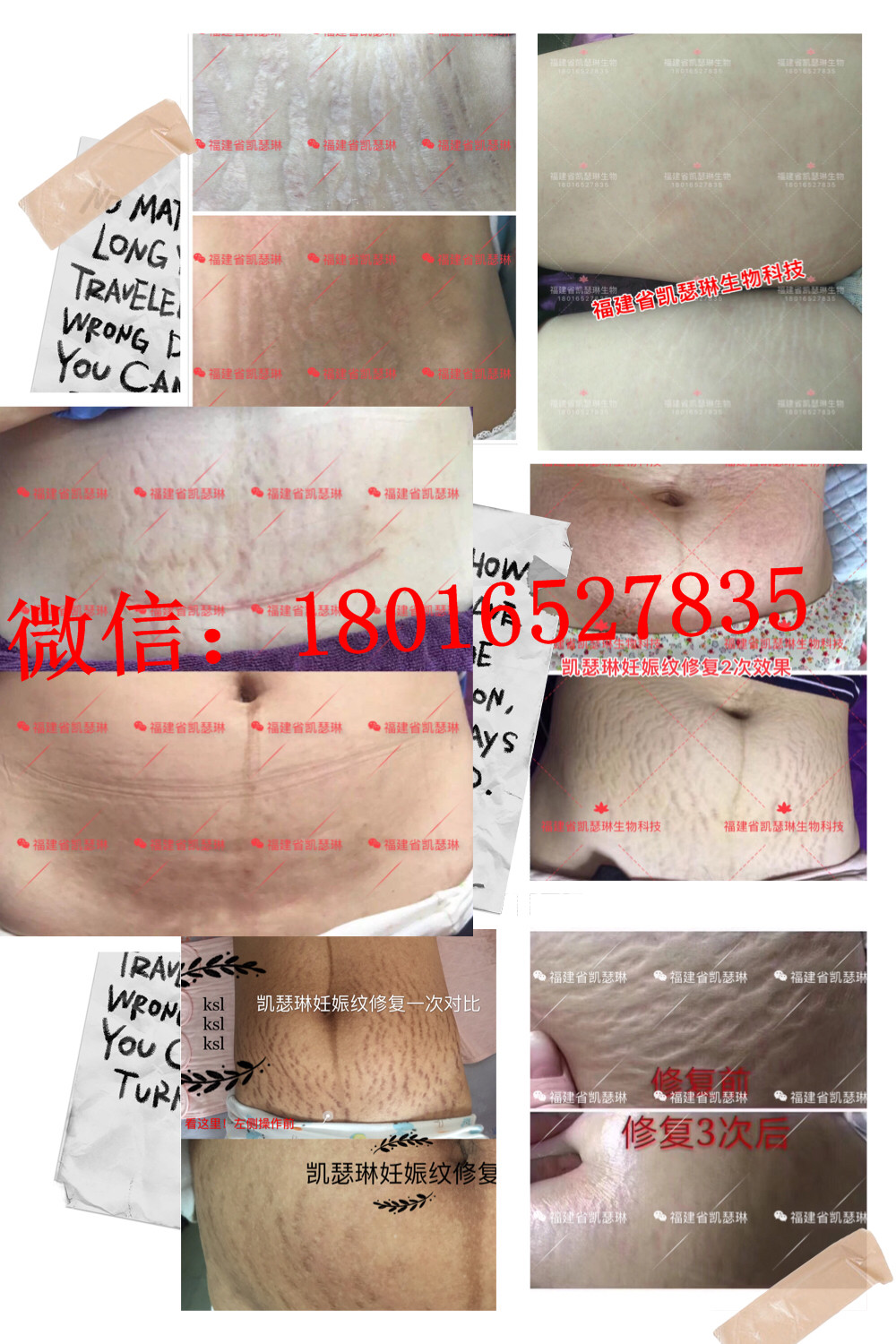 四平博仕后*修復(fù)加盟多少錢