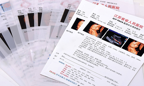 西臣邦尼醫(yī)用打印膠片 醫(yī)用高清膠片