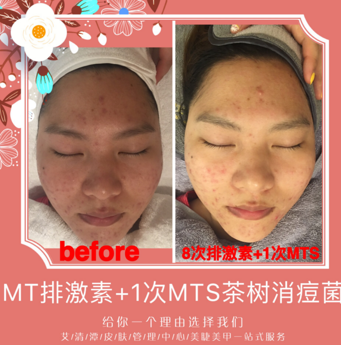 北京皮膚管理培訓(xùn)學(xué)校到哪個(gè)更專業(yè)