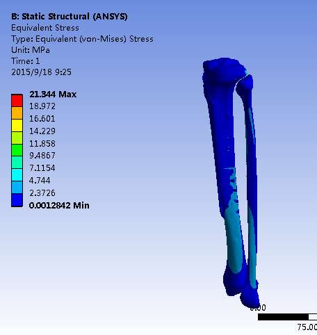 供應(yīng)用于有限元分析專業(yè)ANSYS有限元分析培訓(xùn)非標(biāo)自動化設(shè)計(jì)機(jī)械行業(yè)ANSYS有限元分析培訓(xùn)