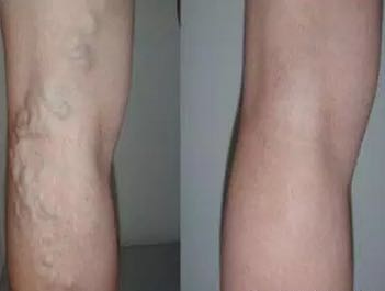 NUSKIN如新華茂牌紅曲*，紅曲，華茂紅曲*