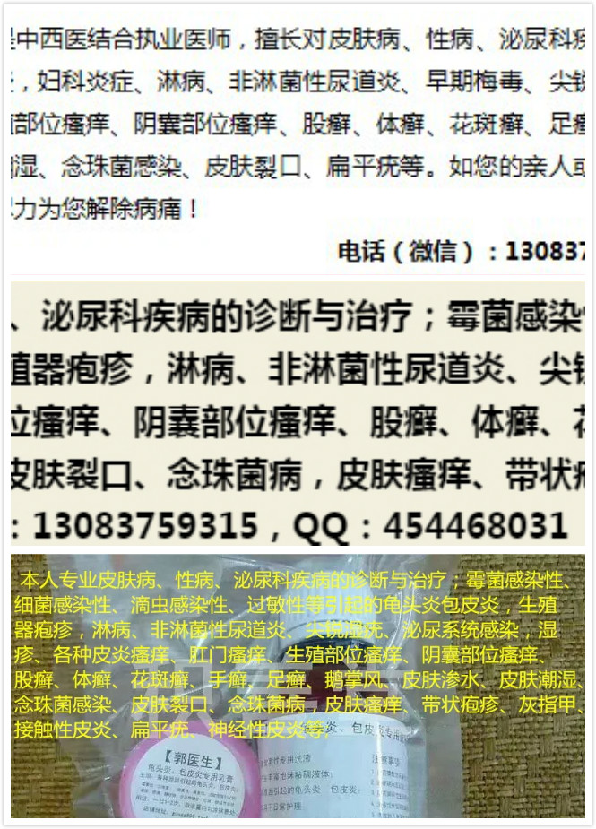 婦科炎癥、婦科感染、婦科病、*炎、霉菌性、滴蟲性、*性*炎，*瘙癢、異味、豆腐渣樣白帶、灼熱感、