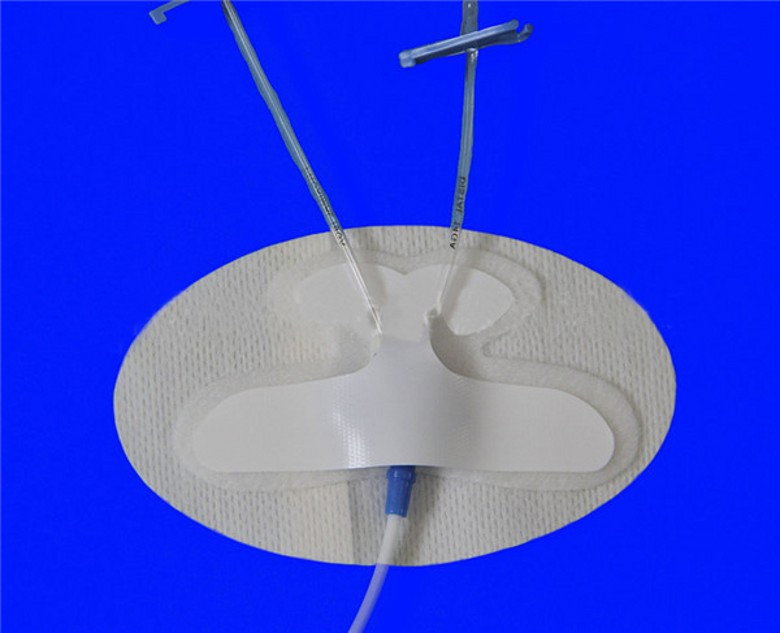 中心靜脈導(dǎo)管固定裝置,PICC導(dǎo)管固定裝置