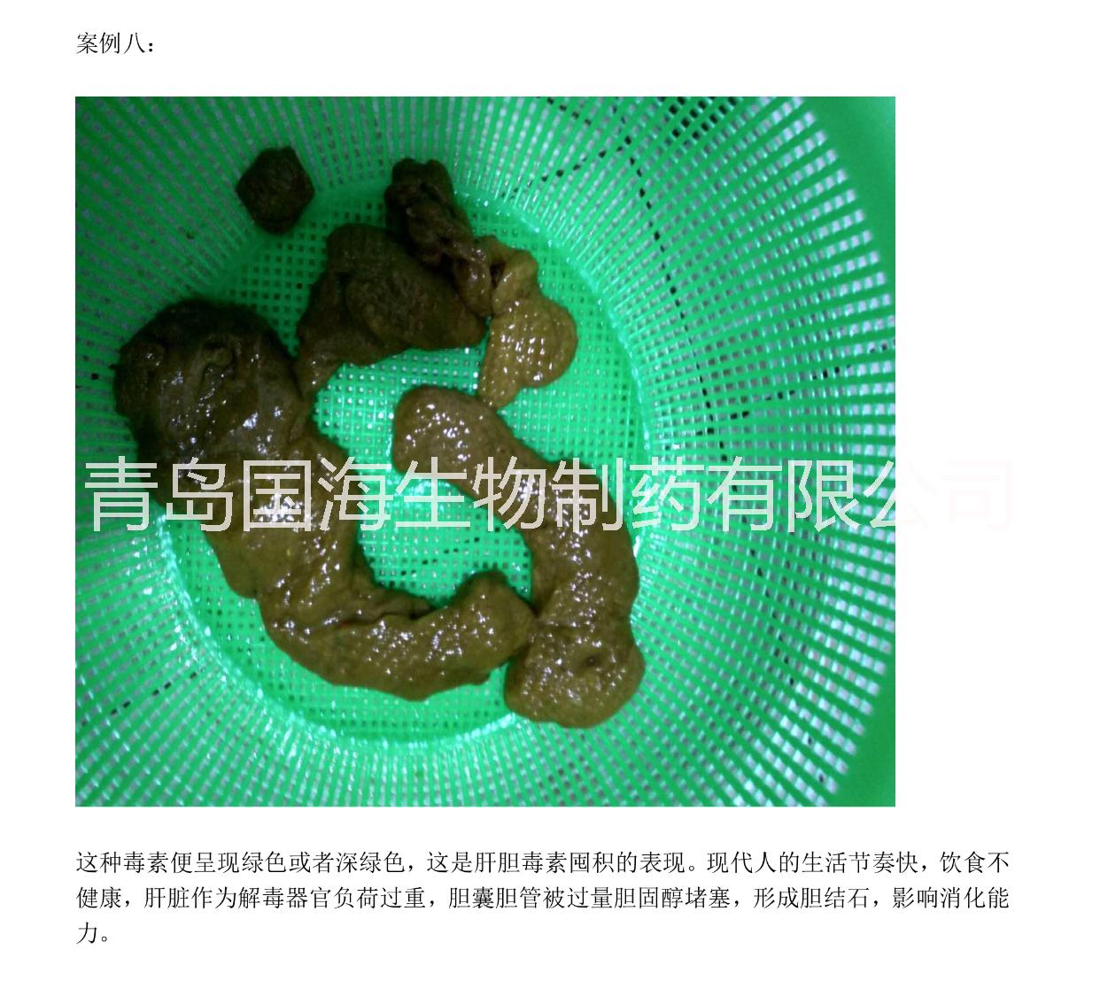 腸道* 腸道*供應OEM、代理
