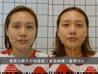 日式整骨效果怎么樣？在哪可以學(xué)日式整骨？