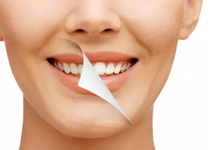牙齒縫隙問(wèn)題該怎么解決？齒哈尼牙齒貼面美白，牙齒美容