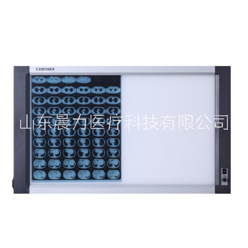 醫(yī)用LED一聯(lián)二聯(lián)三聯(lián)四聯(lián)觀片燈，方便觀看兩到三張片子