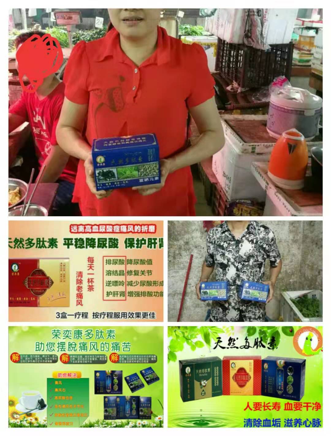 榮奕康天然多肽素與痛風(fēng)的關(guān)系