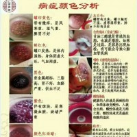 春草類貼牌 春草類拔罐招商加盟      拔罐液生產(chǎn)廠家