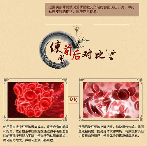 上海托瑪林艾灸貼報(bào)價(jià)，批發(fā)，廠家