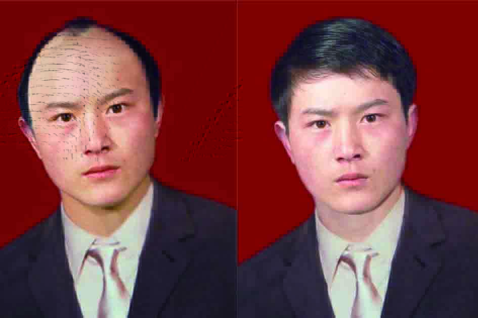 南陽頂美假發(fā) 定制隱形補(bǔ)發(fā)假發(fā)