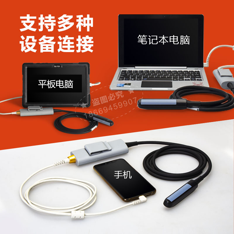 山西 高清牛用B超機(jī)供應(yīng)商，牛馬驢動(dòng)物懷孕檢測(cè)儀價(jià)格