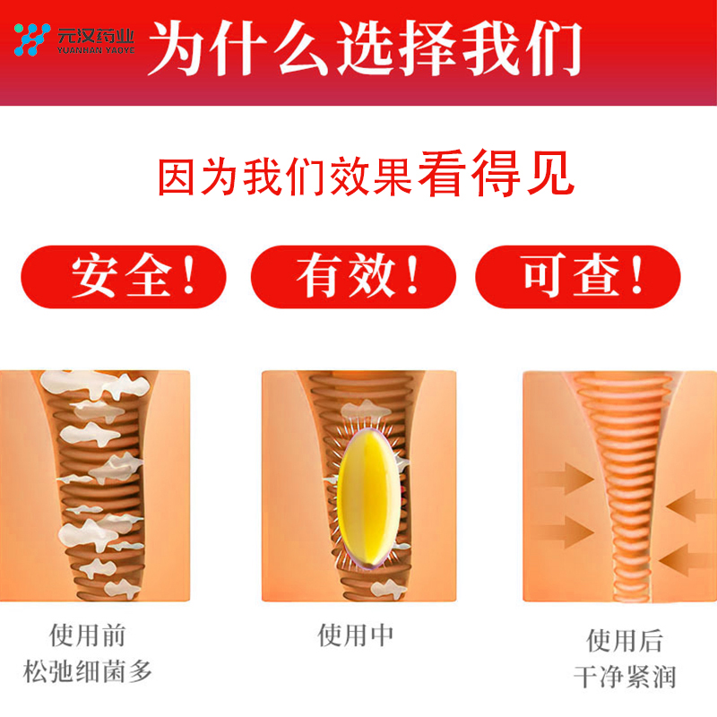 愛計(jì)劃婦科緊潤(rùn)小黃丸套盒植物草本精華萃取女性私處清潔護(hù)理液 愛計(jì)劃婦科浸潤(rùn)小黃丸套盒