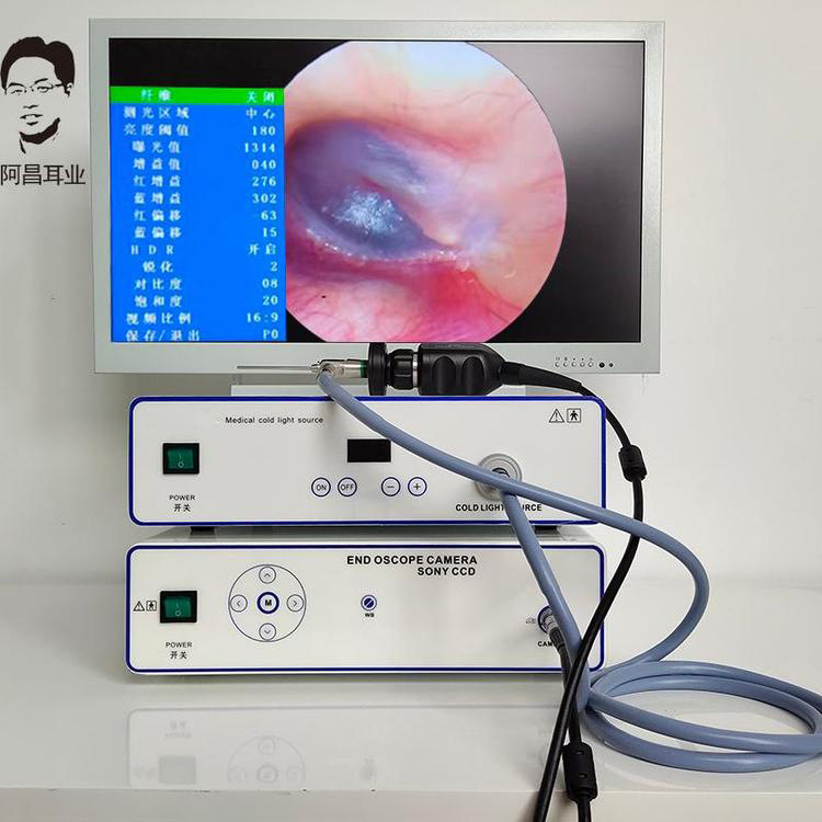 可視采耳設(shè)備臺式高清耳鼻喉冷光源掏耳朵儀器專業(yè)開店掏耳朵機(jī)器